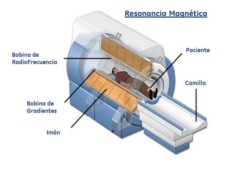 ¿Qué es la resonancia magnética y cómo funciona?